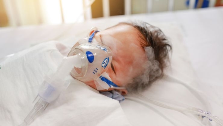 Allarme virus respiratorio sinciziale per i neonati-sintomi e cure